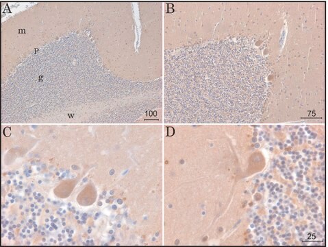 モノクロナール抗KCNK9 (TASK-3) clone KCN-75, purified from hybridoma cell culture