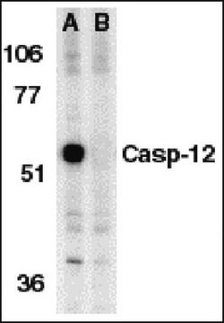 Anti-Caspase 12 Antibody, prodomain, aa 100-116 Chemicon&#174;, from rabbit