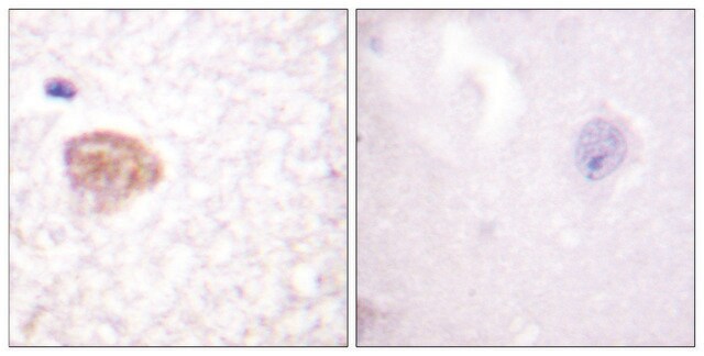 Anti-DDX3 antibody produced in rabbit affinity isolated antibody