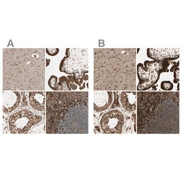 抗CANX ウサギ宿主抗体 Ab2, Prestige Antibodies&#174; Powered by Atlas Antibodies, affinity isolated antibody, buffered aqueous glycerol solution