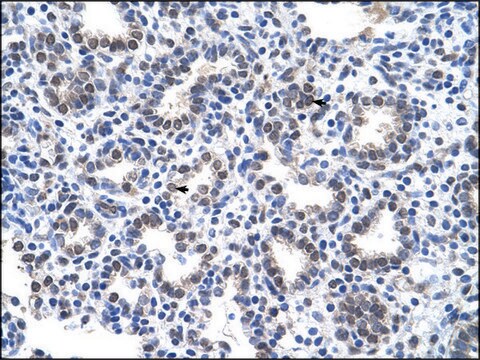 Anti-SLC22A16 antibody produced in rabbit IgG fraction of antiserum