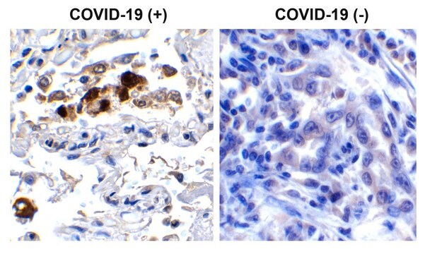 Anty-SARS-CoV-2(COVID-19) Spike RBD affinity isolated antibody