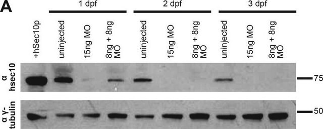 Anti-&#947;-Tubulin Antibody, clone 6T10A1, Rabbit Monoclonal