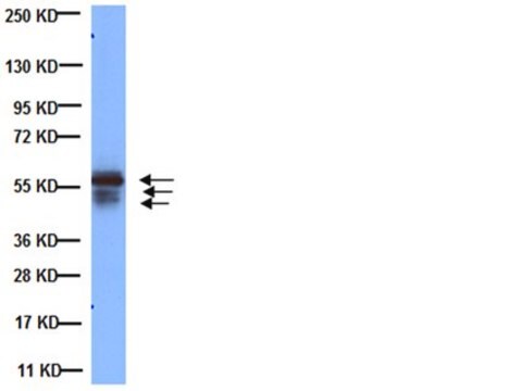 Anti-Cytokeratin AE1/AE3-Antikörper, erkennt saure und basische Zytokeratine, Klon&nbsp;AE1/AE3 clone AE1/AE3, Chemicon&#174;, from mouse