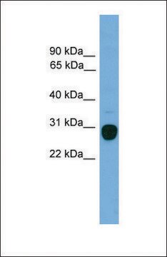 Anti-TREM2 antibody produced in rabbit affinity isolated antibody