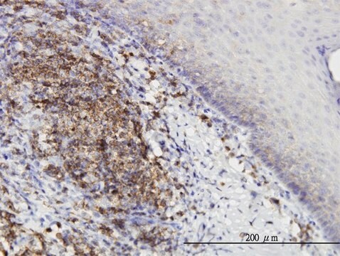 Monoclonal Anti-PRKD2 antibody produced in mouse clone 2E4, purified immunoglobulin, buffered aqueous solution