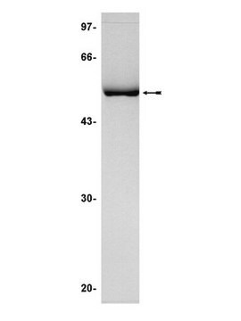 JNK2&#945;2/SAPK1a Protein, active, 10 &#181;g Active, N-terminal His-tagged, full length human JNK2&#945;2/SAPK1a, for use in Kinase Assays.