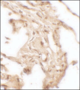 Anti-WFDC2 antibody produced in rabbit affinity isolated antibody