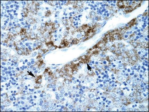 Anti-SLC30A9 (AB1) antibody produced in rabbit affinity isolated antibody