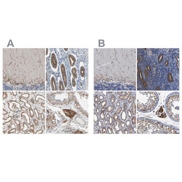 Anti-CLCC1 antibody produced in rabbit Ab1, Prestige Antibodies&#174; Powered by Atlas Antibodies, affinity isolated antibody, buffered aqueous glycerol solution