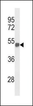 ANTI-FOXG1 (CENTER) antibody produced in rabbit affinity isolated antibody, buffered aqueous solution