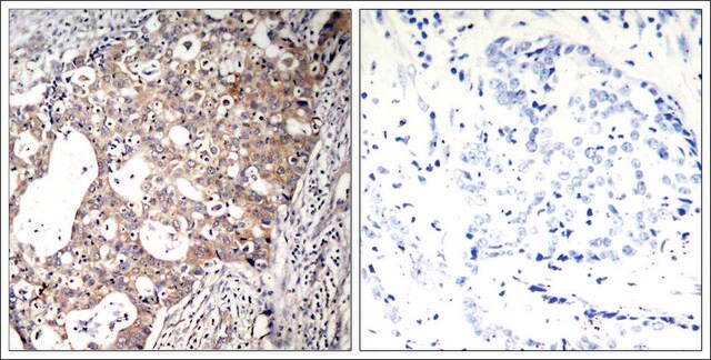 Anti-phospho-SHC1 (pTyr427) antibody produced in rabbit affinity isolated antibody