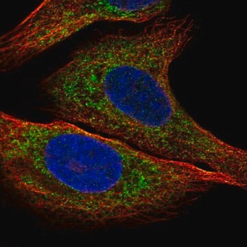 Anti-IGFBP2 antibody produced in rabbit Prestige Antibodies&#174; Powered by Atlas Antibodies, affinity isolated antibody