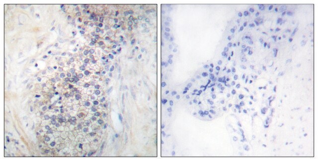 抗LRAT抗体 ウサギ宿主抗体 affinity isolated antibody