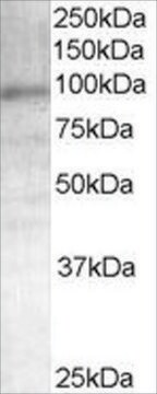 抗アンドロゲンレセプター抗体 ヤギ宿主抗体 affinity isolated antibody, buffered aqueous solution