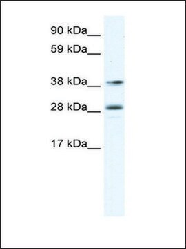 抗MEF2B抗体 ウサギ宿主抗体 IgG fraction of antiserum