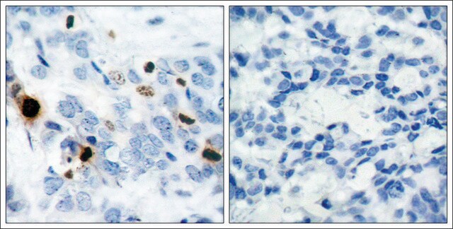 Anti-phospho-HIST1H3D (pSer10) antibody produced in rabbit affinity isolated antibody