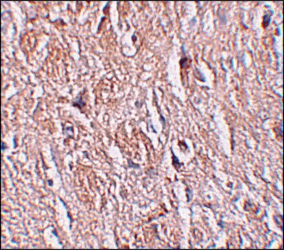 Anti-LRRTM4 antibody produced in rabbit affinity isolated antibody