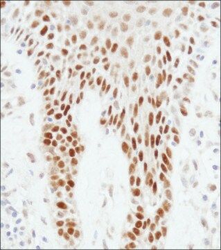 Rabbit anti-p53 Antibody, Affinity Purified