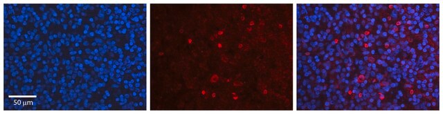 Anti-USF1 antibody produced in rabbit affinity isolated antibody