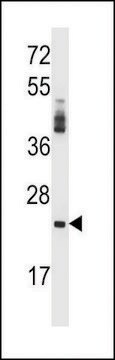 ANTI-PRSS2 (CENTER) antibody produced in rabbit affinity isolated antibody, buffered aqueous solution