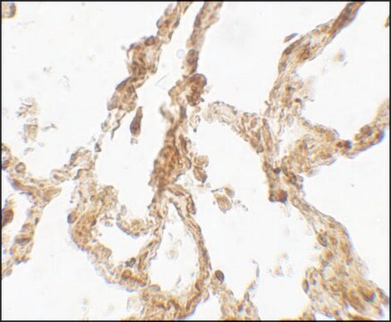 Anti-TRPV4 antibody produced in rabbit affinity isolated antibody