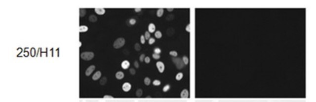 Anti-Progesterone Receptor B Antibody, clone 250/H11 clone 250/H11, from mouse