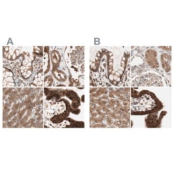 Anti-GALT antibody produced in rabbit Ab2, Prestige Antibodies&#174; Powered by Atlas Antibodies, affinity isolated antibody, buffered aqueous glycerol solution