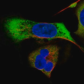 Anti-MAGEB2 antibody produced in rabbit Prestige Antibodies&#174; Powered by Atlas Antibodies, affinity isolated antibody