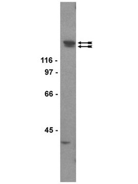 Przeciwciało anty-KDR/Flk-1/VEGFR2, klon CH-11 clone CH-11, Upstate&#174;, from mouse