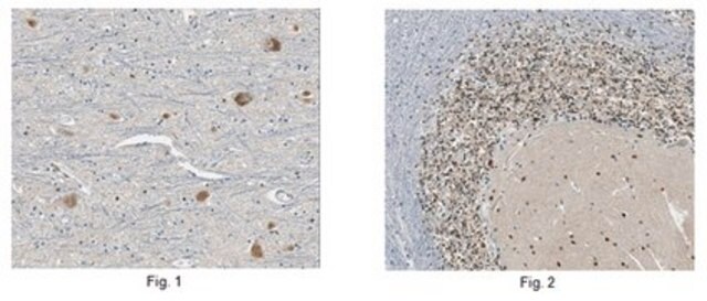 Anti-GluR1 Antibody from rabbit, purified by affinity chromatography