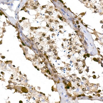 Anti-TET1 Antibody, clone 10S0X1, Rabbit Monoclonal