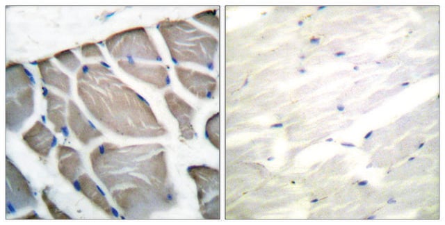 Anti-Actin-pan, C-Terminal antibody produced in rabbit affinity isolated antibody