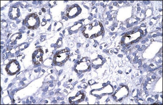 Anti-FOXP1 antibody produced in rabbit IgG fraction of antiserum