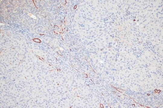 Anti-Phospho-MYL9-T18/S19