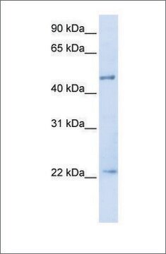 Anti-TRIM21 antibody produced in rabbit affinity isolated antibody