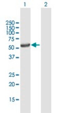 Anti-UGT3A1 antibody produced in mouse purified immunoglobulin, buffered aqueous solution