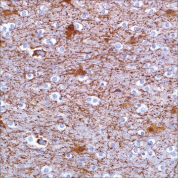 Glial Fibrillary Acidic Protein (GFAP) (SP78) Rabbit Monoclonal Antibody