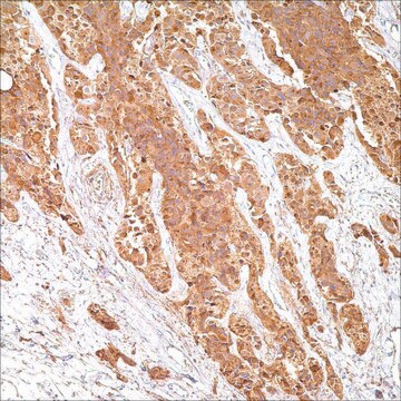 Calcitonin Rabbit Polyclonal Antibody