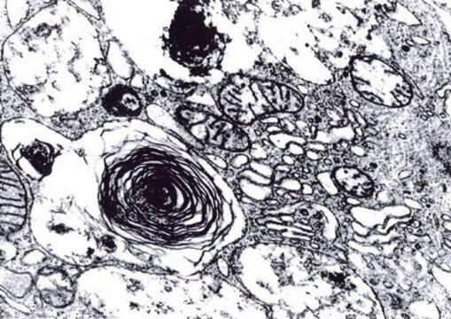 Osmium(VIII) oxide for microscopy