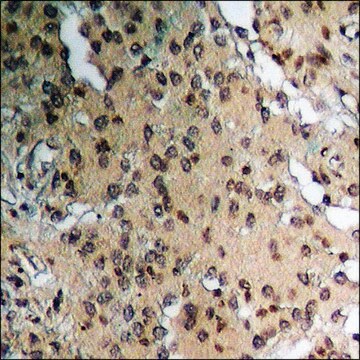 Anti-phospho-HER2 (pTyr877) antibody produced in rabbit affinity isolated antibody