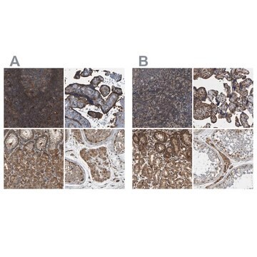 Anti-SAMD9L antibody produced in rabbit Prestige Antibodies&#174; Powered by Atlas Antibodies, affinity isolated antibody, buffered aqueous glycerol solution, Ab2