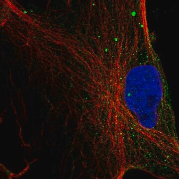 Anti-Mgll Antibody Produced In Rabbit Prestige Antibodies&#174; Powered by Atlas Antibodies, affinity isolated antibody, buffered aqueous glycerol solution