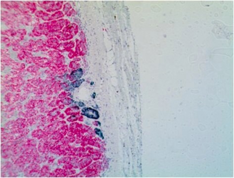 Anticorpo anti-CYP11B2, clone 41-17B clone 41-17B, from mouse