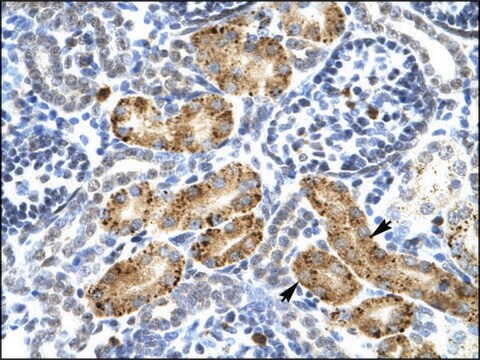 Anti-P2RX2 (AB1) antibody produced in rabbit IgG fraction of antiserum