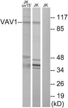 抗VAV1抗体 ウサギ宿主抗体 affinity isolated antibody