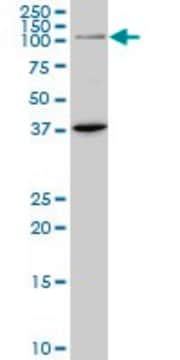 ANTI-PRDM1 antibody produced in mouse clone 1G6, purified immunoglobulin, buffered aqueous solution