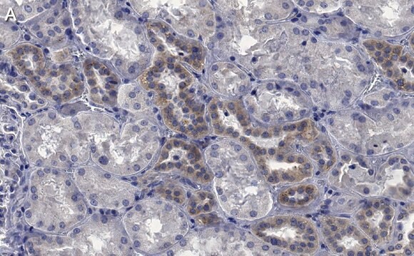 Anti-STX17 Antibody, clone 1B3 ZooMAb&#174; Rabbit Monoclonal recombinant, expressed in HEK 293 cells