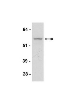 Przeciwciało anty-Akt3/PKBγ, klon GMA104 clone GMA104, Upstate&#174;, from mouse