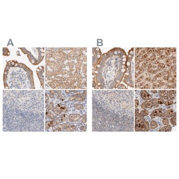 Anti-HDHD3 antibody produced in rabbit Prestige Antibodies&#174; Powered by Atlas Antibodies, affinity isolated antibody, buffered aqueous glycerol solution, Ab2